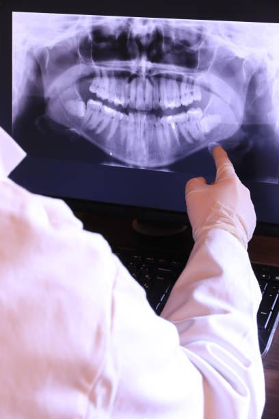 Best Emergency Gum Treatment in Hemby Bridge, NC
