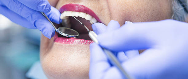 Best Emergency Treatment for Dental Infections or Abscesses in Hemby Bridge, NC